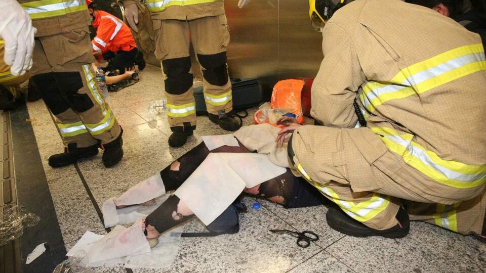 港鐵縱火事件中，有OL絲襪率先着火，導致下身三級燒傷。(經濟日報資料圖片)