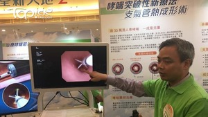 楊耀昌表示，外國文獻顯示手術可減少重哮喘發作48%。（經濟日報記者攝）