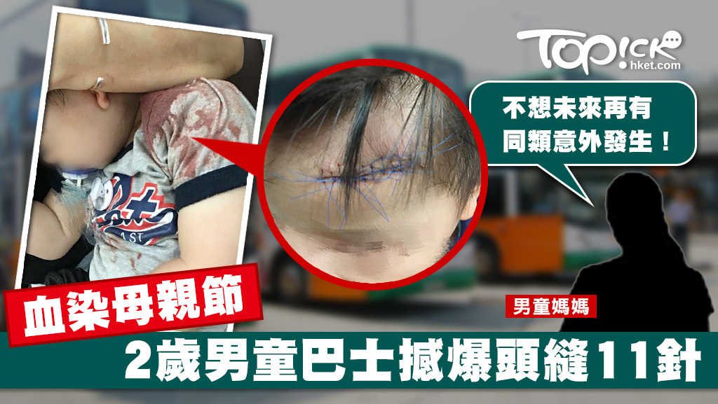 2歲男童巴士掟彎沒企穩，撼爆額頭縫11針，男童媽媽公開事件，盼提醒家長小心。