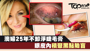 本港皮膚科專科醫生陳厚毅建議市民在卸妝的時候，要對著鏡仔細卸妝，確保妝容卸乾淨才去洗澡。
