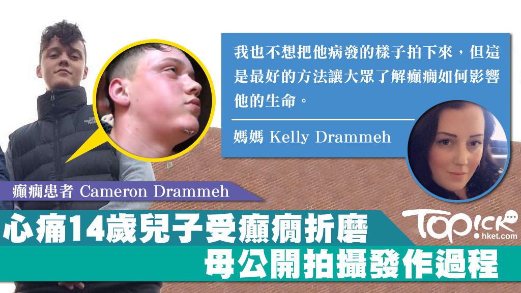 Cameron自7歲起確診癲癇，他的母親為喚起大眾對癲癇的關注和認識，決定拍攝Cameron癲癇發作的過程並上載至Facebook。