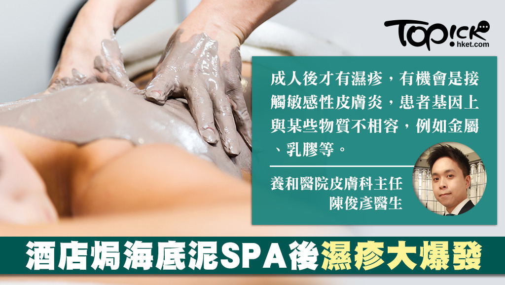 濕疹不一定自小發病，有人在酒店焗海底泥SPA後爆發濕疹，醫生相信是基因上與某些物質㷴不相容。