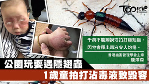 小孩在公園玩耍，沾上隱翅蟲毒液致手臉泛紅和冒膿包。