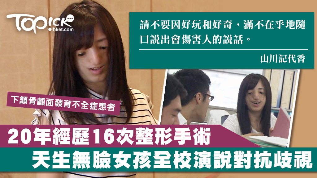 下頷骨顱面發育不全症患者山川記代香鼓起勇氣，向同學說出心聲，令她日後變得更自信。。