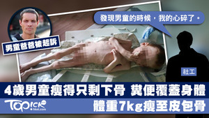 在烏克蘭發生一宗令人心碎的虐兒案，一名4歲男童被餓至營養不良，體重僅7公斤。