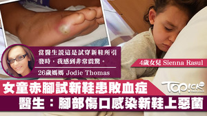 4歲女童疑腳上有傷口，致細菌入血感染敗血病。