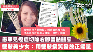患癌少女留下截肢，用來搞笑發放正能量。