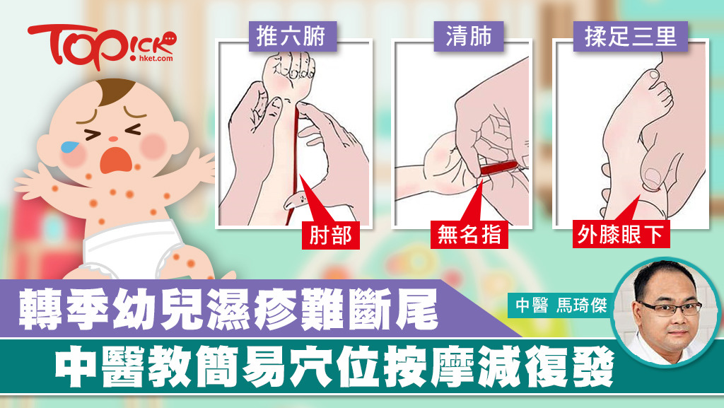 中醫教簡易穴位按摩助減低幼兒濕疹復發。