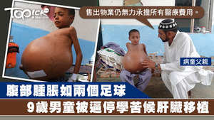 肝臟移植手術費高達3萬5千英鎊，失業的Aneet爸爸呼籲政府及民眾籌款幫忙。