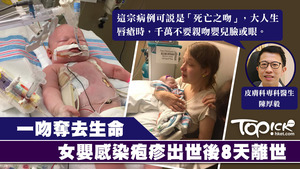 女嬰遭大人親吻感染疱疹出世8天離世。
