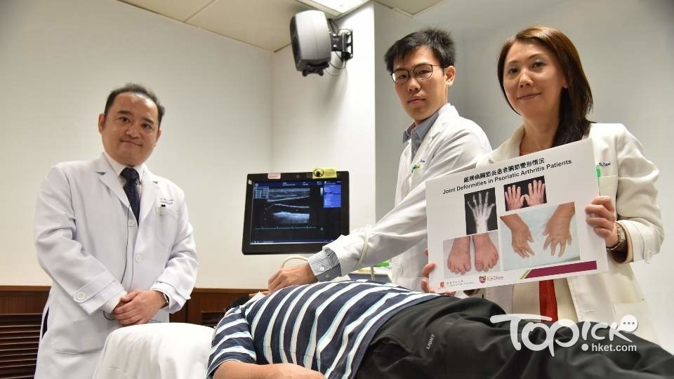 銀屑病影響廣泛，中大研究全球首次證實，銀屑病關節炎病人如病情受控，可減心血血管病風險。(李明佑攝)