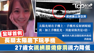 台灣一名27歲年輕女子因長時間在猛烈陽光下用手機，導致視網膜穿洞，成全球首例。