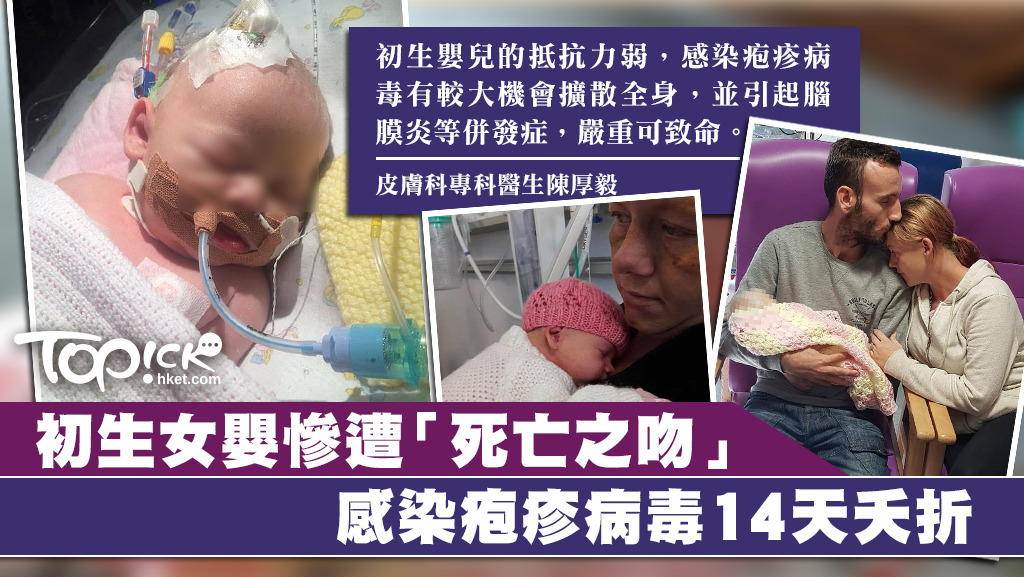 初生女嬰感染疱疹病毒14天夭折。