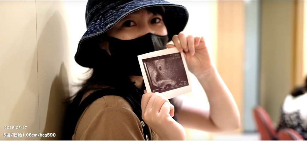 看到胎兒的情況健康令顆顆非常開心。（「顆顆 ㅋㅋ • 流氓夫妻」facebook影片截圖）