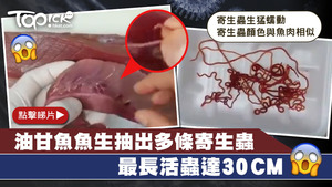 片段可見寄生蟲長短不一，長度由10至30CM不等。
