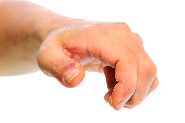 甲溝炎患者或會有膿頭出現。(圖片來源：istock)