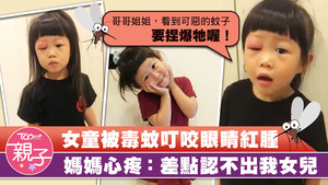 女童的眼睛被蚊子咬到無法睜開！