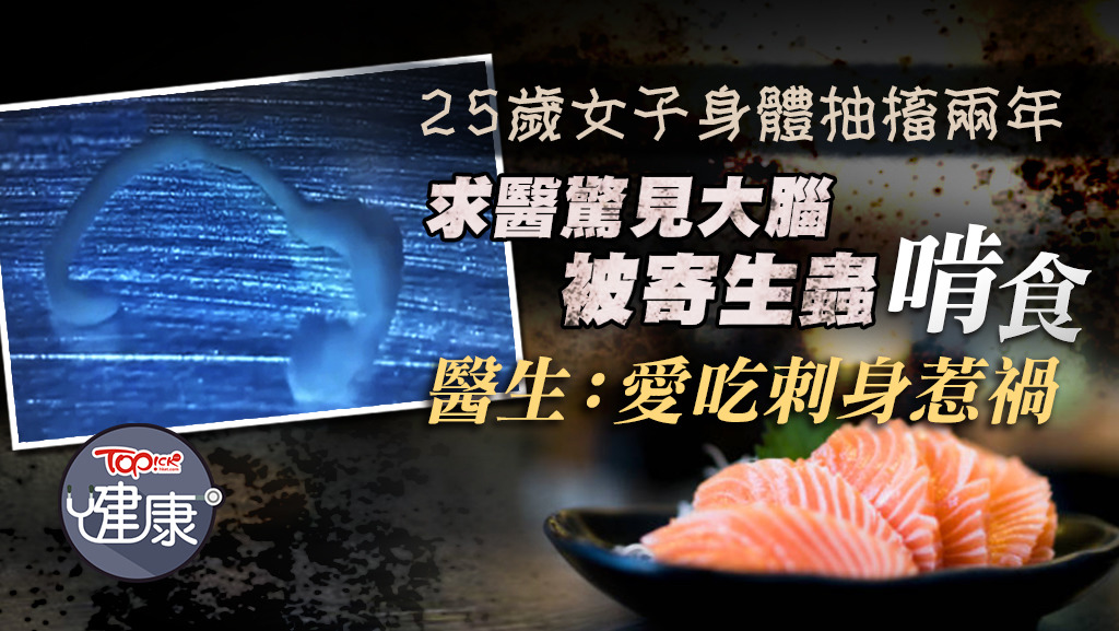 25歲女子愛食刺身右邊身抽搐兩年，求醫驚見腦藏5厘米長生猛寄生蟲。