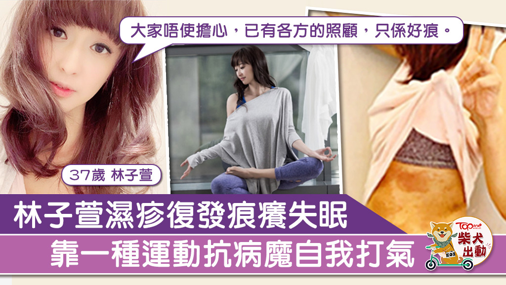 林子萱濕疹復發。