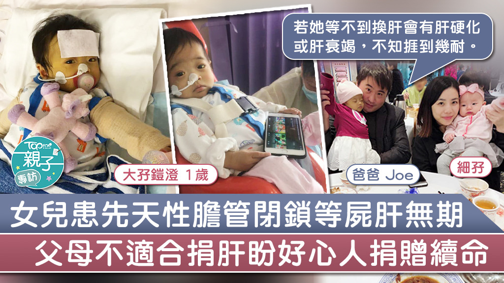 1歲的鎧澄患先天性膽管閉鎖，父母盼好心人捐肝給女兒續命。
