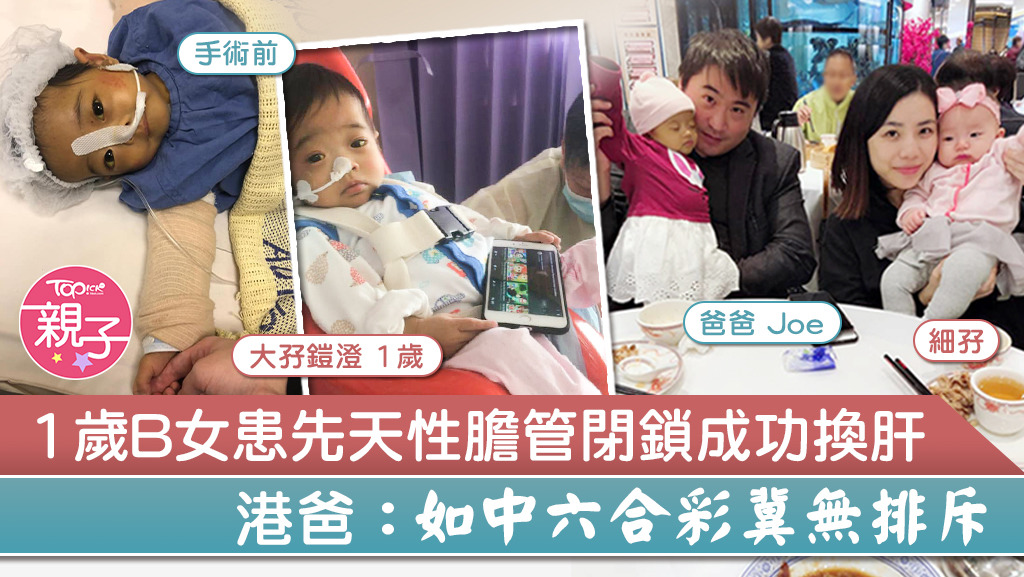 1歲B女鎧澄患先天性膽管閉鎖成功獲屍肝移植。