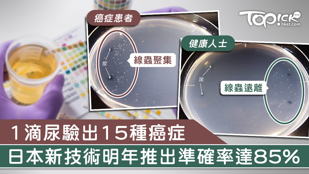 日本有企業近日研發出利用尿液，即可驗出測試者是否患癌，新技術將於明年推出。