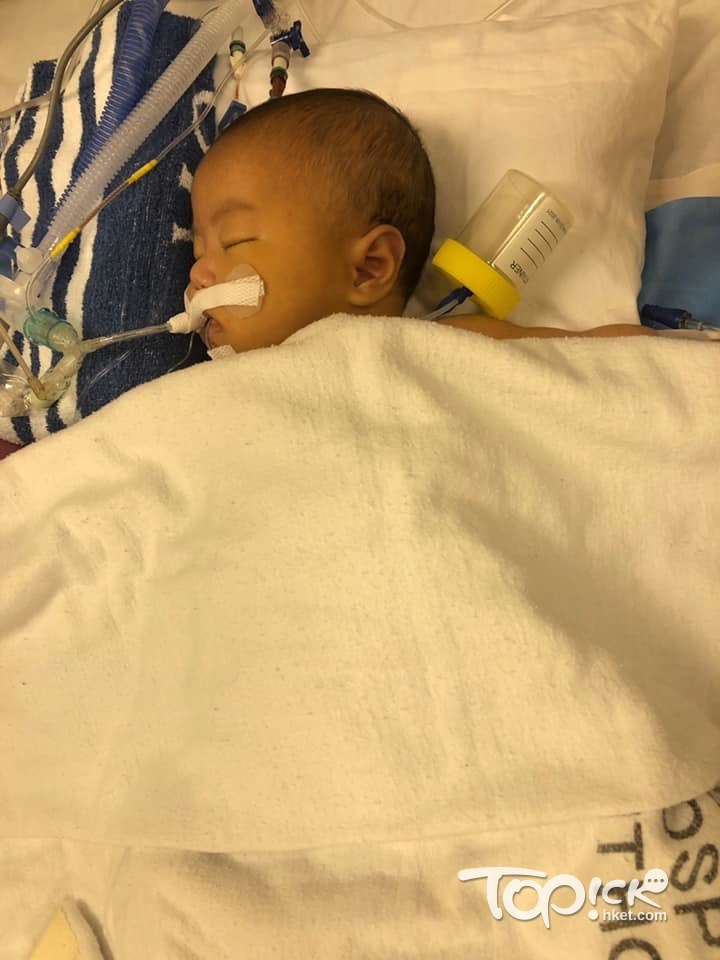 媽媽在除夕日當天發現攸攸的膚色明顯比前一天更黃，擔心女兒患病，帶同女兒到醫院看病。（受訪者提供）