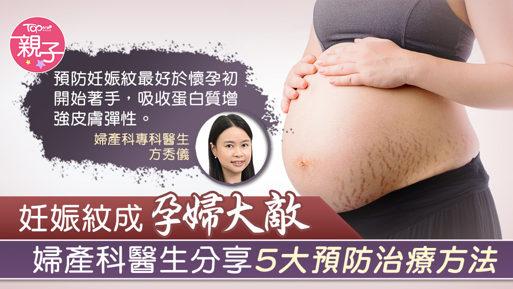 不少媽媽因妊娠紋的出現而感到自卑，TOPick訪問婦產科專科醫生方秀儀，分享5大預防及治療方法。