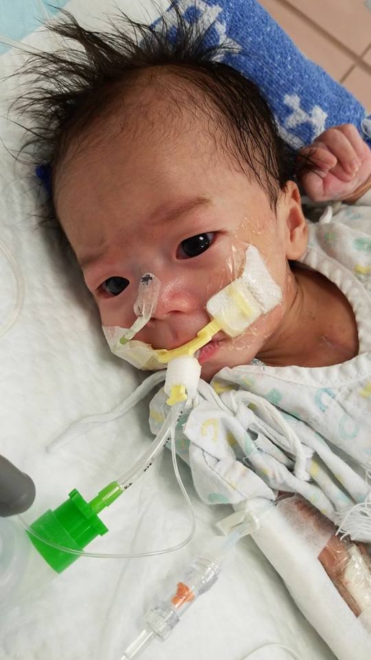 小鐵漢出生就經歷3次大手術。（小鐵漢媽媽facebook圖片）