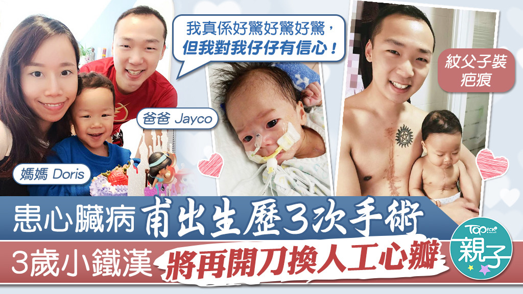 3歲小鐵漢將會再開刀換人工心瓣。