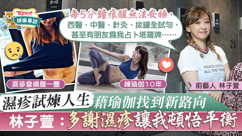 對抗濕疹6年的林子萱，最近的濕疹情況已改善不少，她說已了解到其實每當濕疹復發，就是提醒她壓力已超標。