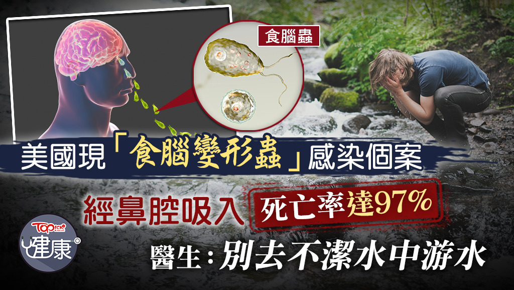 美國現「食腦變形蟲」感染個案。