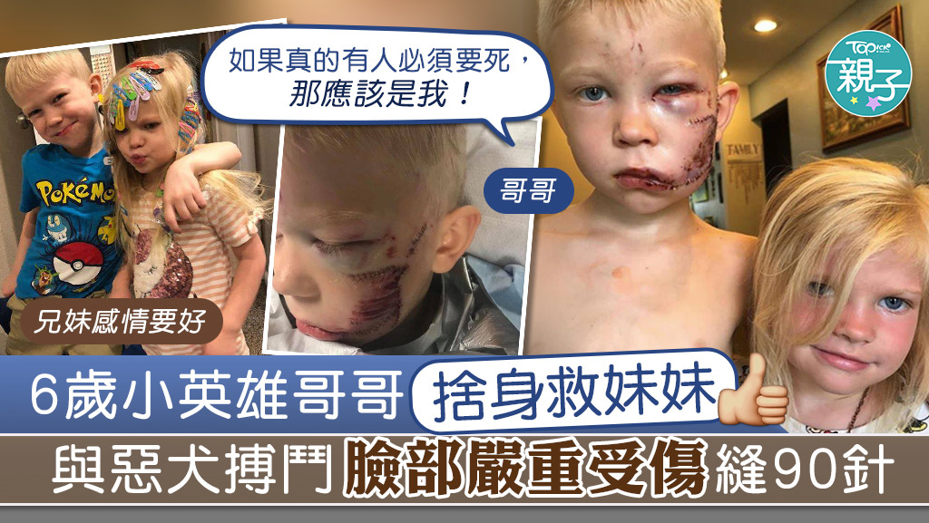6歲哥哥為救妹妹，與惡犬搏鬥致嚴重受傷。