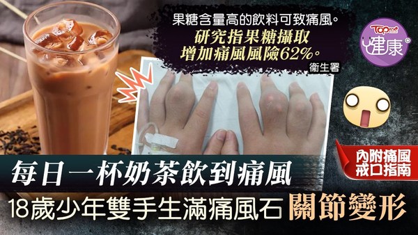 內地一名18歲少年平均每日飲一杯奶茶，導致手腳關節長滿痛風石。