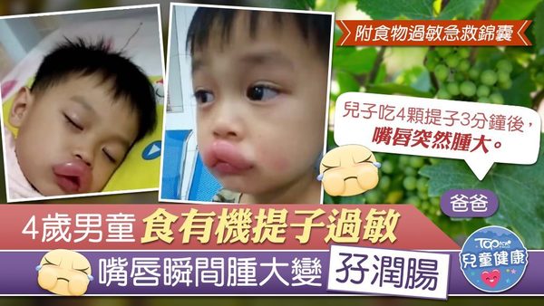 內地一名4歲男童因食有機提子後過敏，嘴唇腫大變孖潤腸。