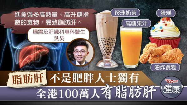 進食過多高糖、高脂食物易致脂肪肝。