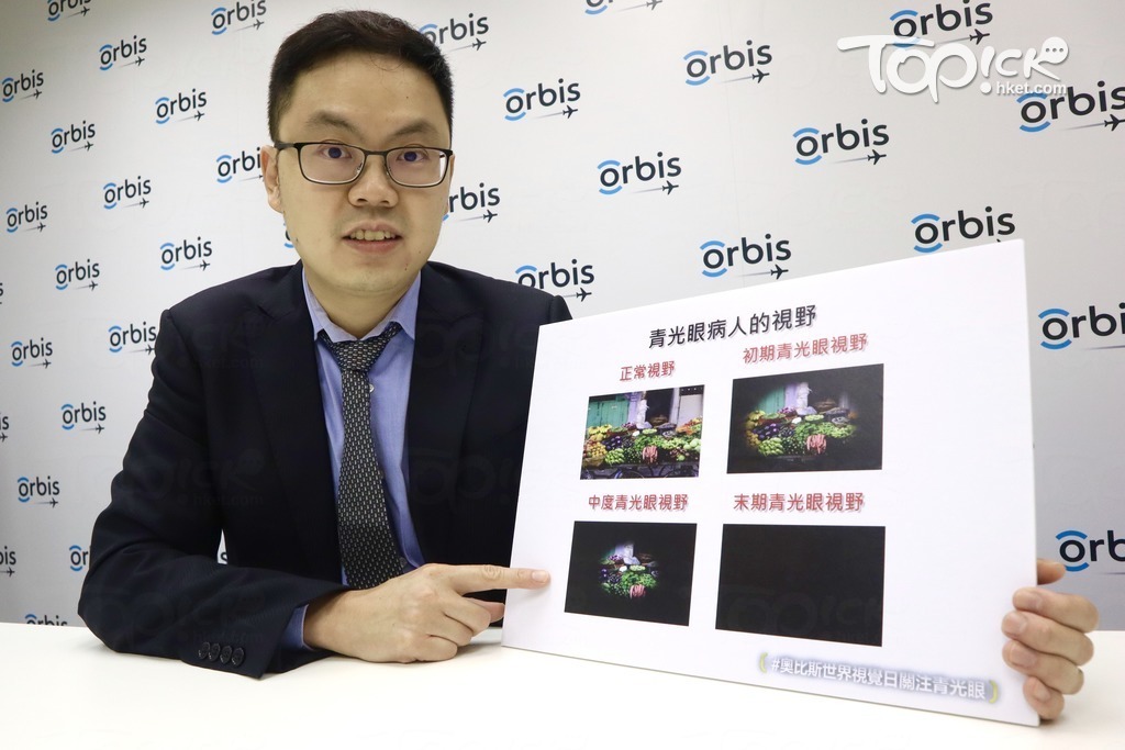 何穎流醫生表示，慢性青光眼患者早期沒有症狀，到發現視野收窄已發展至病情中後期階段。（奧比斯提供）
