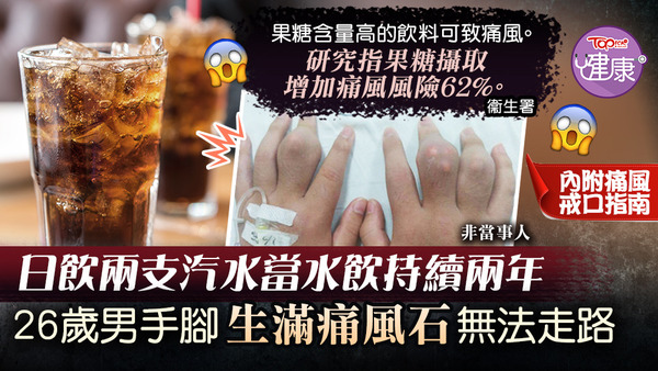 日飲兩支汽水當水飲持續兩年，26歲男手腳生滿痛風石無法走路。
