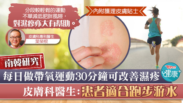 做運動有助改善濕疹問題