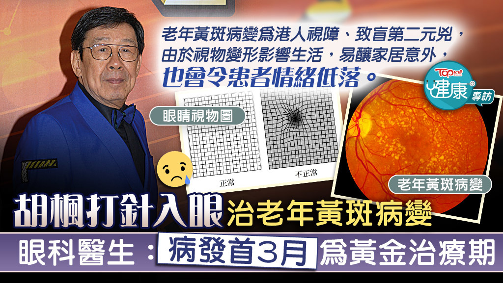 老年黃斑病變病徵可分初、中及晚期，初期患者可能毫無病徵。