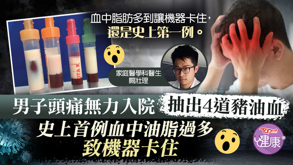 德國一名男子因頭痛無力、噁心而求醫，抽血檢查時竟抽出4道乳白色液體。
