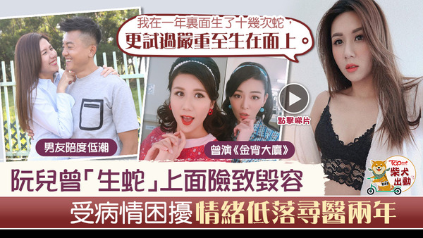 「荷蘭妹」阮兒一直受「生蛇」困擾。