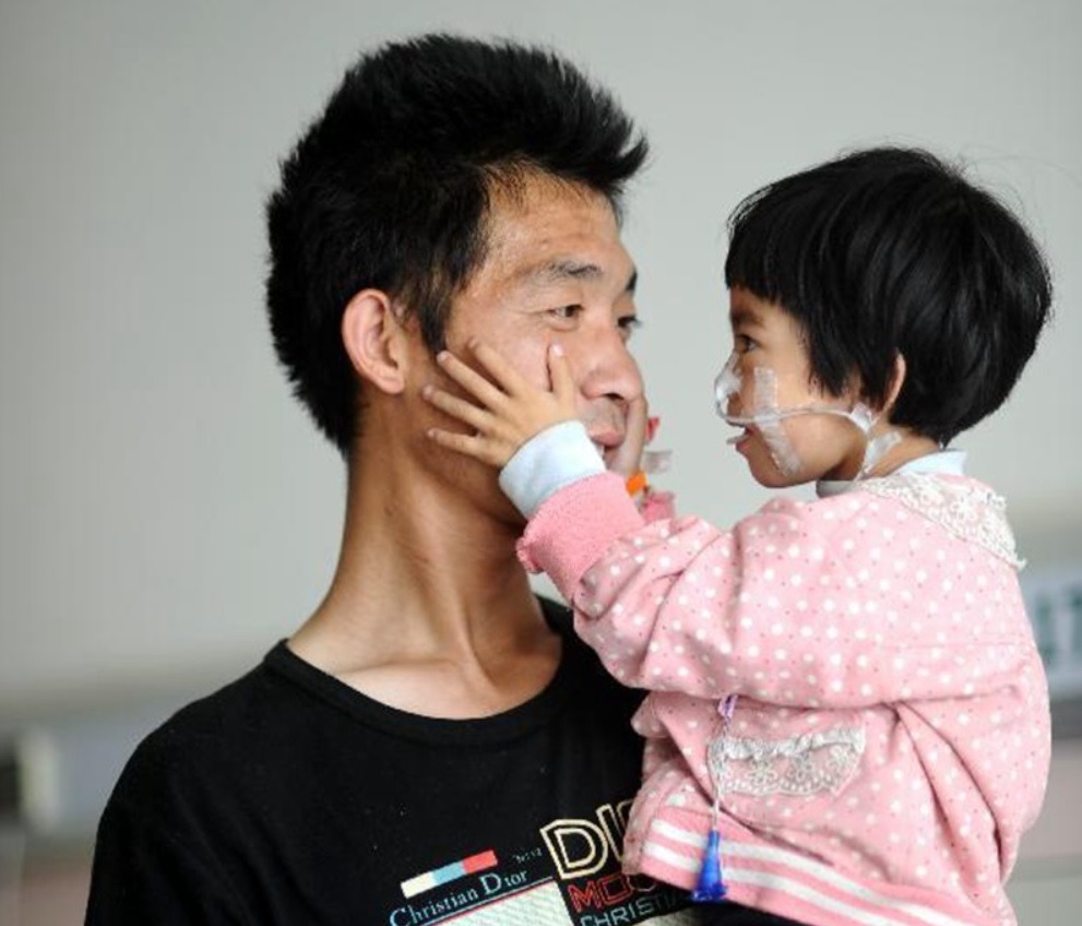 爸爸無怨無悔照顧女兒，父女相依為命。（網上圖片）
