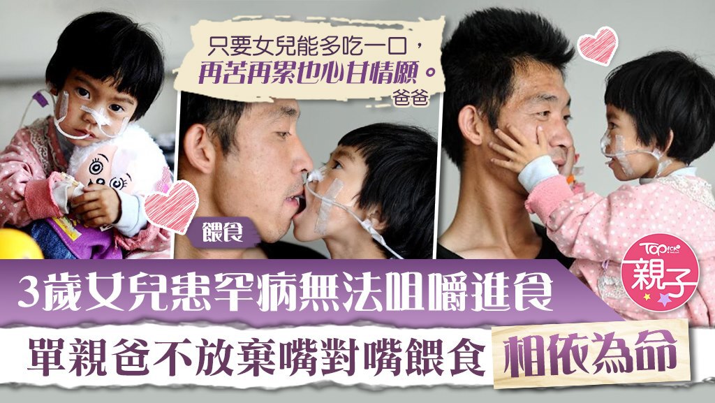 因3歲女兒患罕見病無法進食，內地一名單親爸爸嘴對嘴餵愛女。