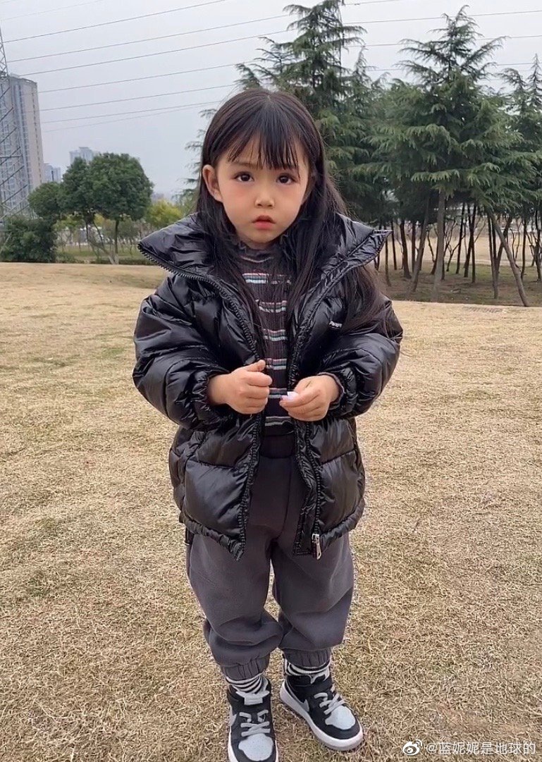 擁有天使面孔的妮妮患有罕見基因病。（微博圖片）