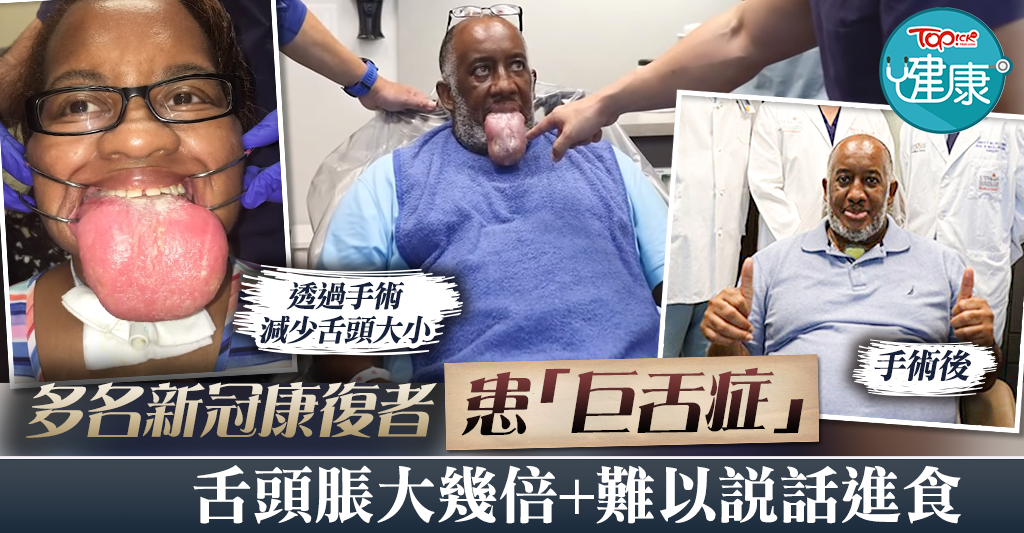 巨舌症とは – 舌が分厚くなる病気 – MKALL