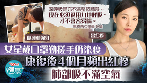女星戴口罩勤搓手仍染疫，康復後4個月頻出紅疹，肺部吸不滿空氣。