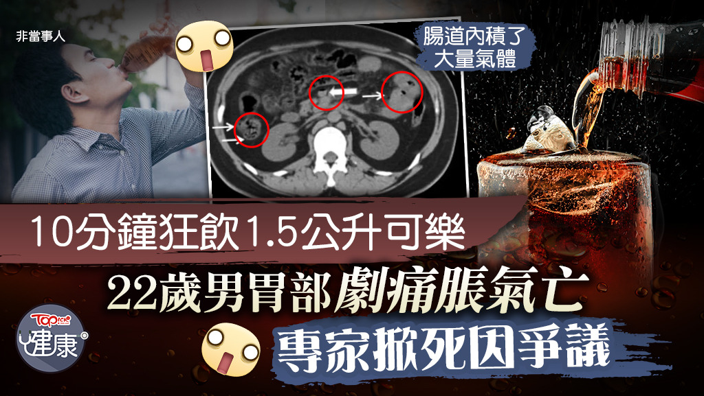22歲少年10分鍾內狂灌1.5公升可樂，肝臟缺氧慘死。