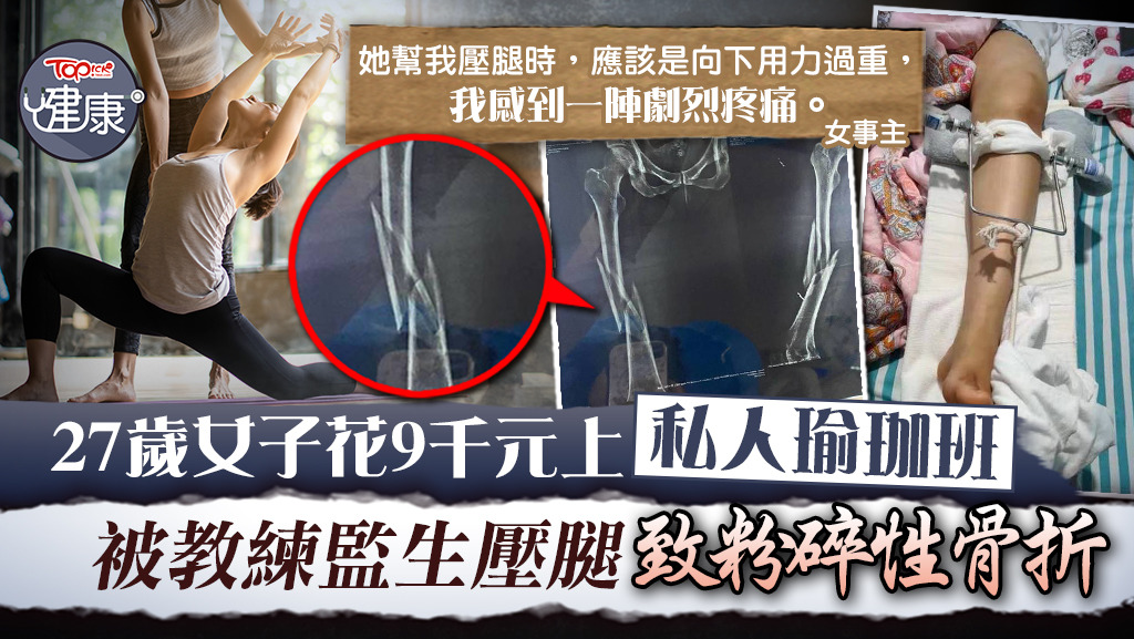 運動意外 27歲女子花9千元上私人瑜珈班被教練監生壓腿致粉碎性骨折 香港經濟日報 Topick 健康 健康資訊 D