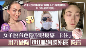 女子脫有色隱形眼鏡覺得「卡住」，用力硬除扯出眼角膜外層險盲。